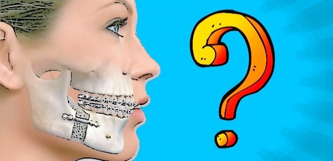 Ağzımı Açarken Çenemden Kemik Sesi Geliyor