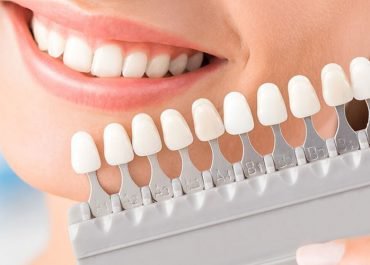 Yaprak Porselen Nedir?