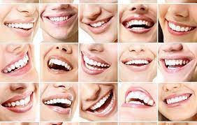 Yüz Şekline Göre Diş Modelleri